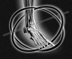 Foot and Ankle Physical Therapy Continuing Education Course